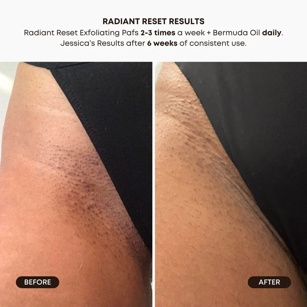 Radiant Reset | Exfoliating Toner Pads