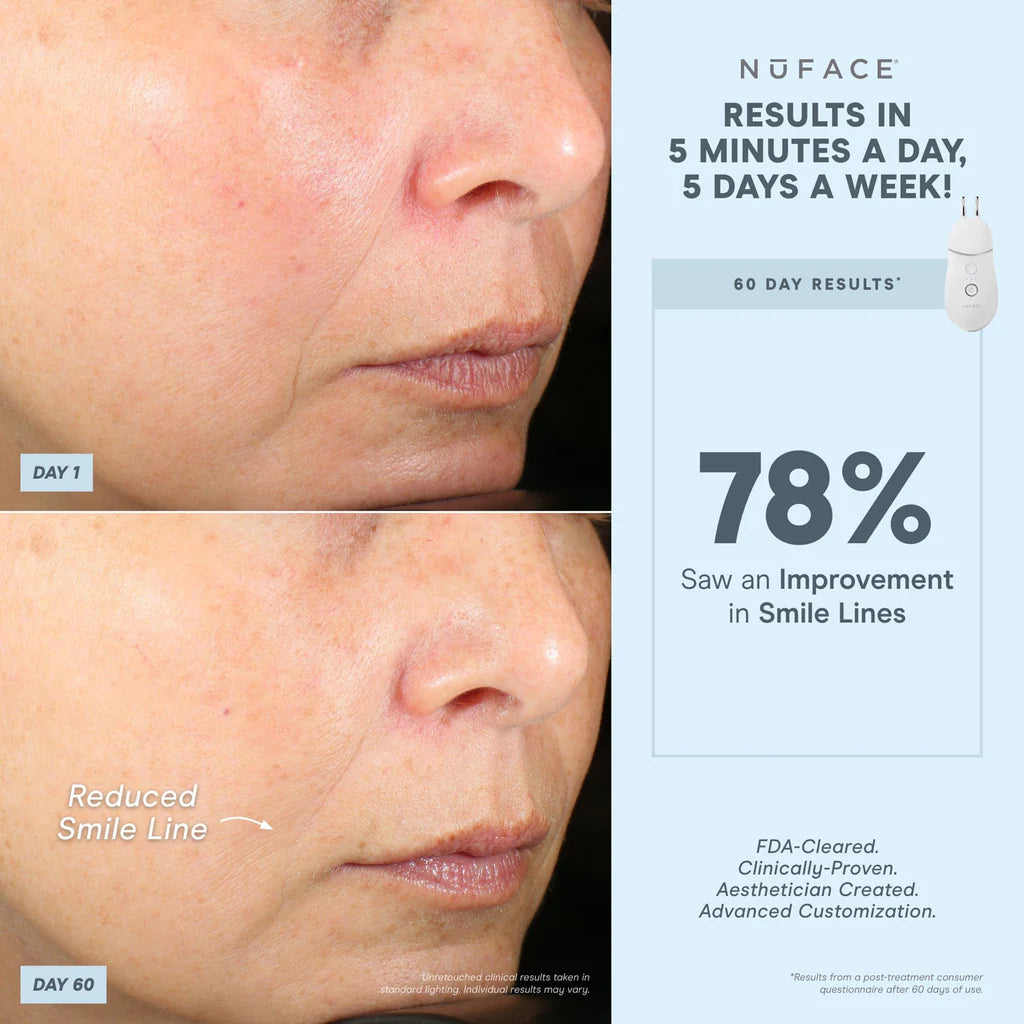 NuFACE ELE+ Effective Lip & Eye Attachment for Trinity+ Pro Device