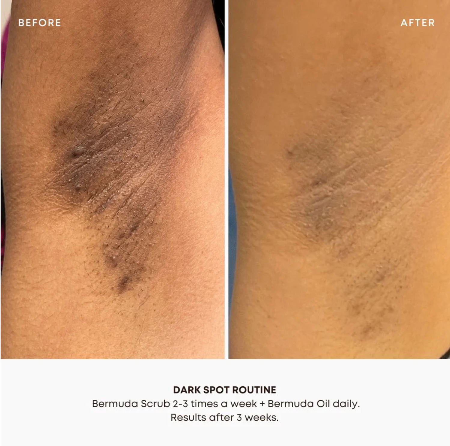 Burmuda | Dark Spot Oil | Rejuvenate & Brighten