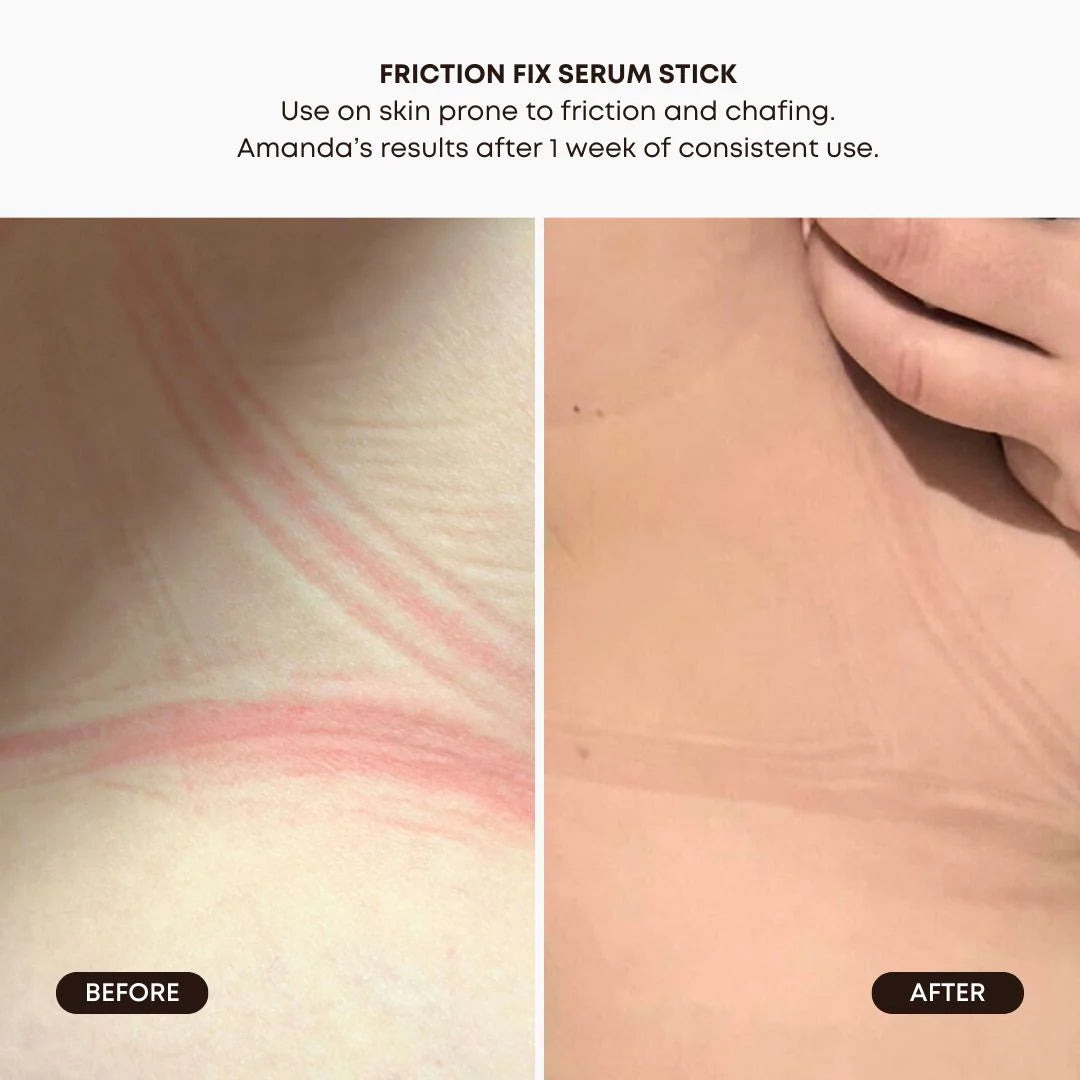 Friction Fix Serum Stick | Anti-Chaffing