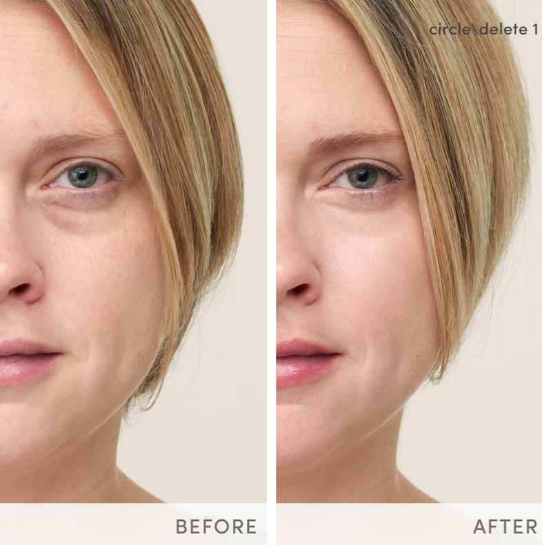 Circle\Delete® Concealer