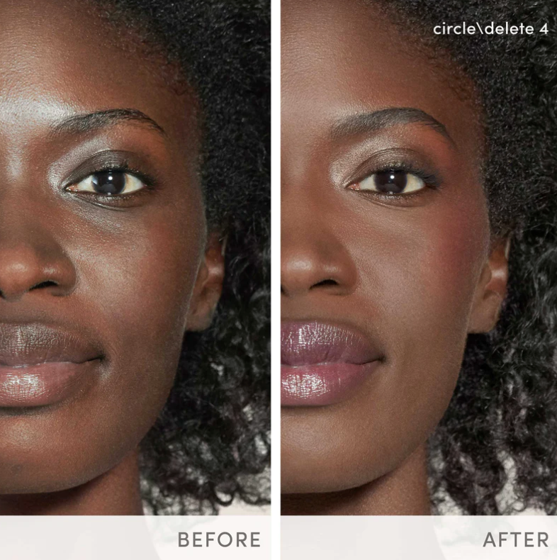 Circle\Delete® Concealer